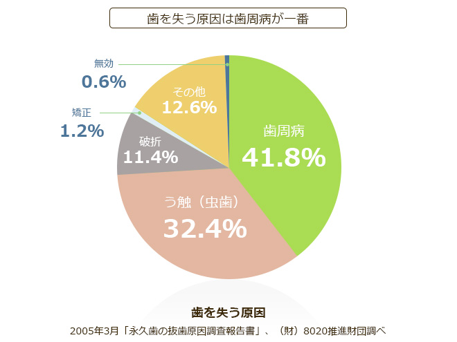 歯周病は歯を失う原因の1位